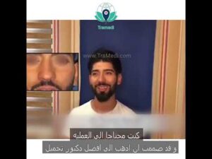 سجاد wurde mit einer Nasenoperation zu einem attraktiveren jungen Mann